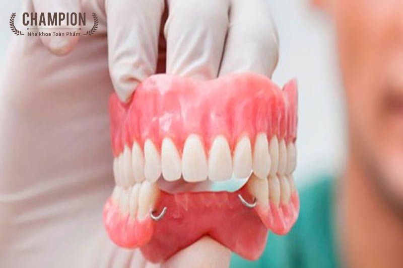 Removable Dentures