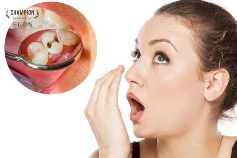 Hôi miệng là bệnh gì? Nguyên nhân và biện pháp khắc phục hiệu quả