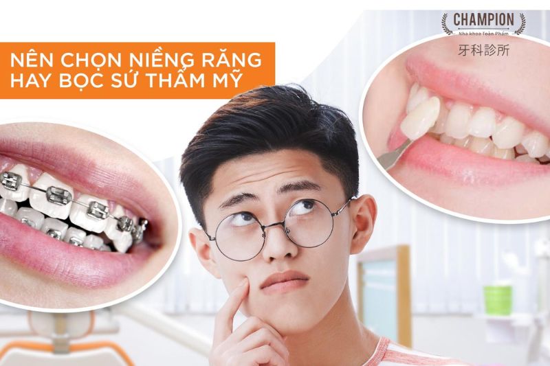 Nên lựa chọn niềng răng hay bọc sứ?