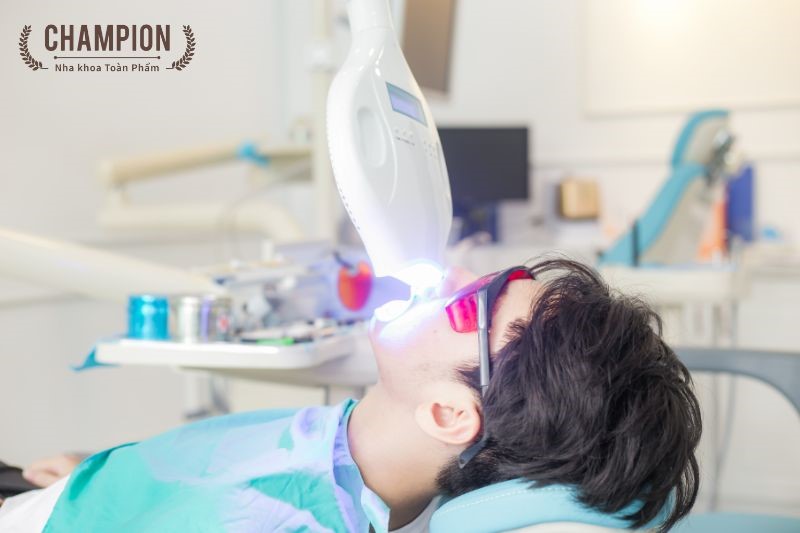 Công nghệ tẩy trắng răng bằng laser tại nha khoa Champion