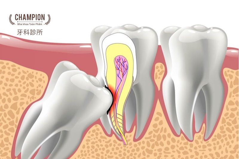 Chăm sóc răng miệng đúng cách