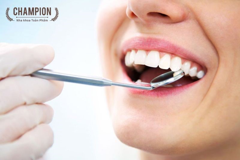 Có nên cạo vội răng và tẩy trắng răng cùng lúc?