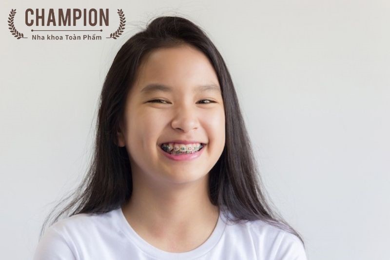 How do I go about getting braces fitted?