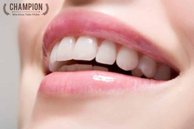 Tại sao nên lựa chọn trồng răng vĩnh viễn với Implant Nobel Biocare