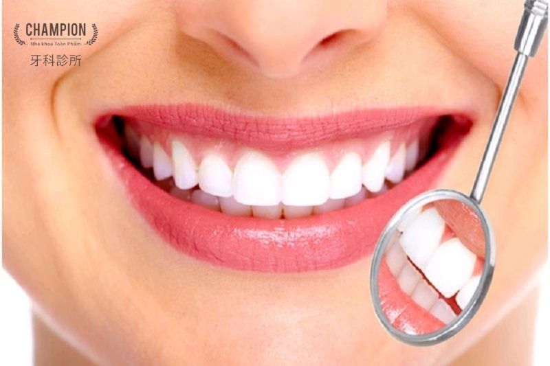 Những lợi ích của việc bọc răng sứ