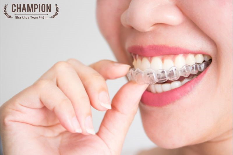 Niềng răng có nguy hiểm không?