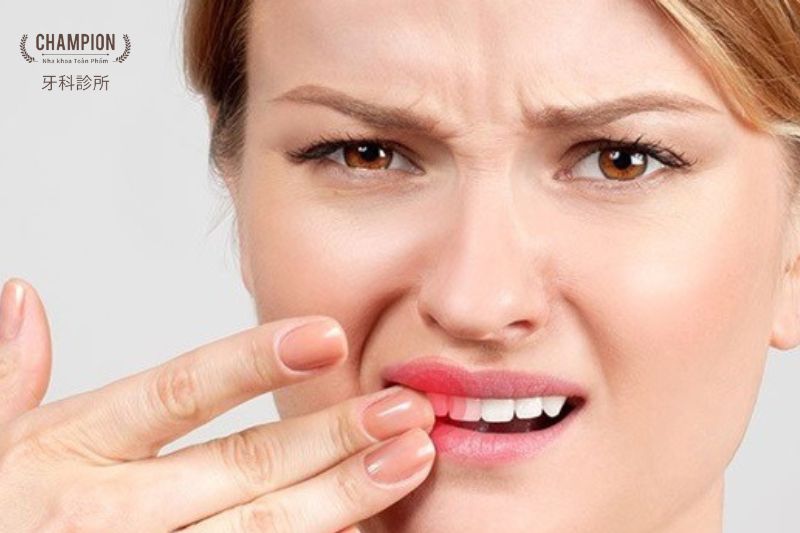 Phải làm thế nào khi răng hàm bị lung lay?