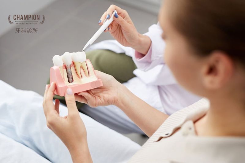 Trồng răng Implant có đảm bảo an toàn tuyệt đối không?