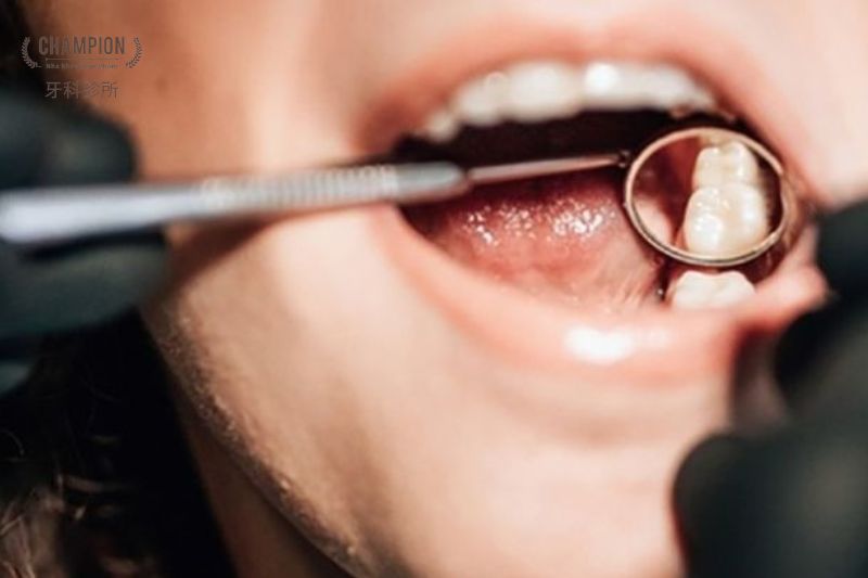 Mách bạn cách chữa đau răng dứt điểm hiệu quả nhanh chóng