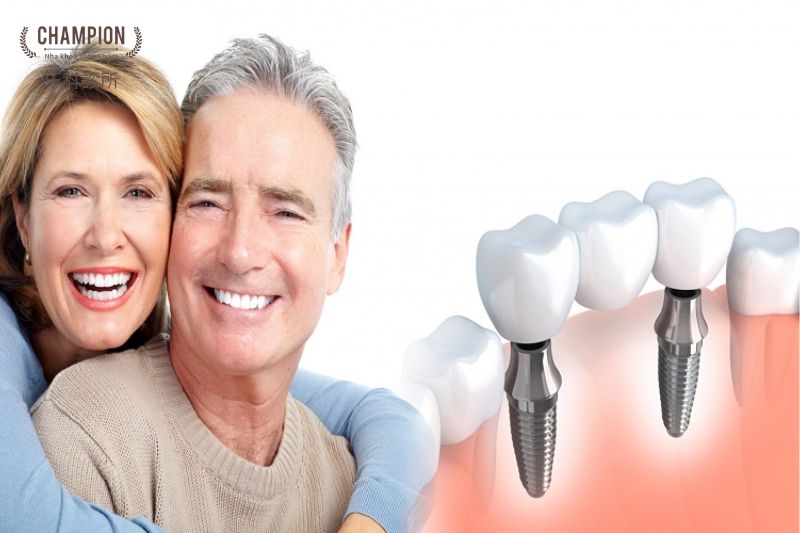 Những yếu tố cần xem xét khi cấy implant cho người lớn tuổi Có nên cấy implant cho người lớn tuổi không?