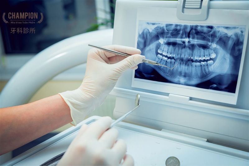 Chẩn đoán nứt răng chính xác: Bí quyết Vàng bảo vệ sức khỏe răng miệng