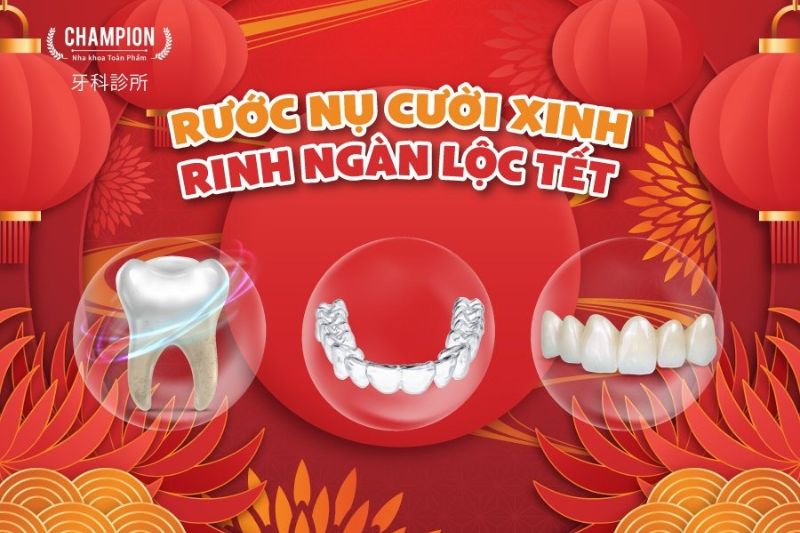 Rước nụ cười xinh - Rinh ngàn lộc Tết cùng Nha Khoa Champion 