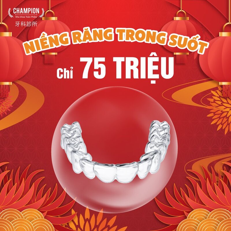 Niềng răng không mắc cài CHỈ 75 TRIỆU