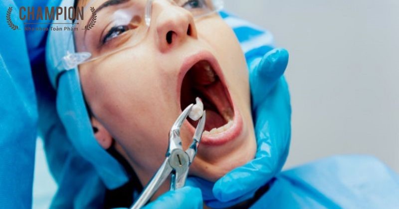 Nhổ răng có đau không? Có gây nguy hiểm gì đến sức khỏe không?