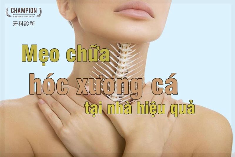 Mẹo chữa hóc xương cá tại nhà hiệu quả