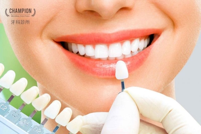 Advantages and Disadvantages of Ceramic Crowns