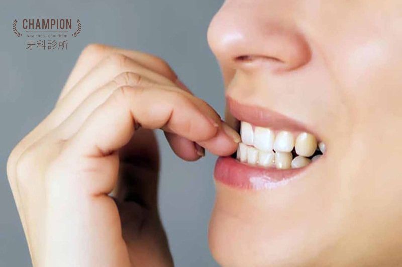 Cách xử lý khi răng bị vỡ mẻ do cắn vật cứng