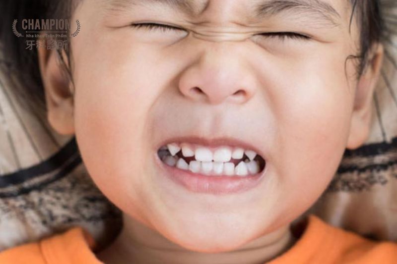 Nghiến răng khi ngủ: Nguyên nhân, tác hại và cách điều trị