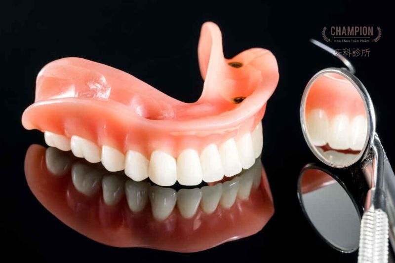 Advantages and Disadvantages of Removable Dentures