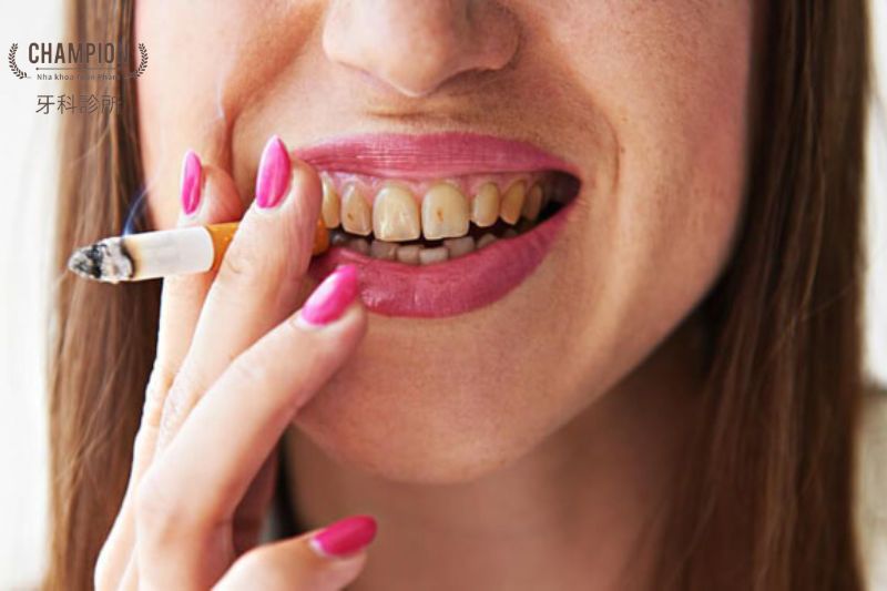 Cách khắc phục và ngăn ngừa khi răng xỉn màu do hút thuốc