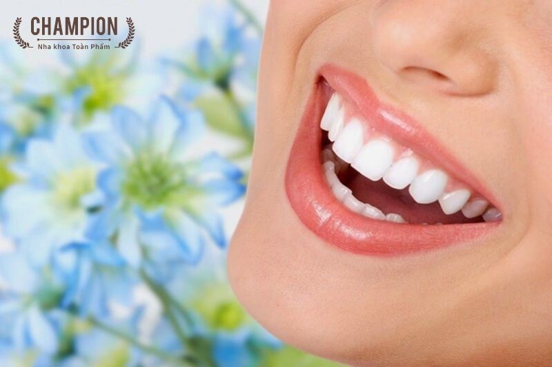Tẩy trắng răng có hại không? Ê buốt sau khi tẩy trắng răng