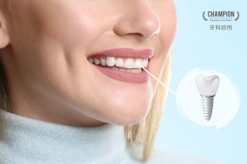 Trồng răng Implant có nguy hiểm không?