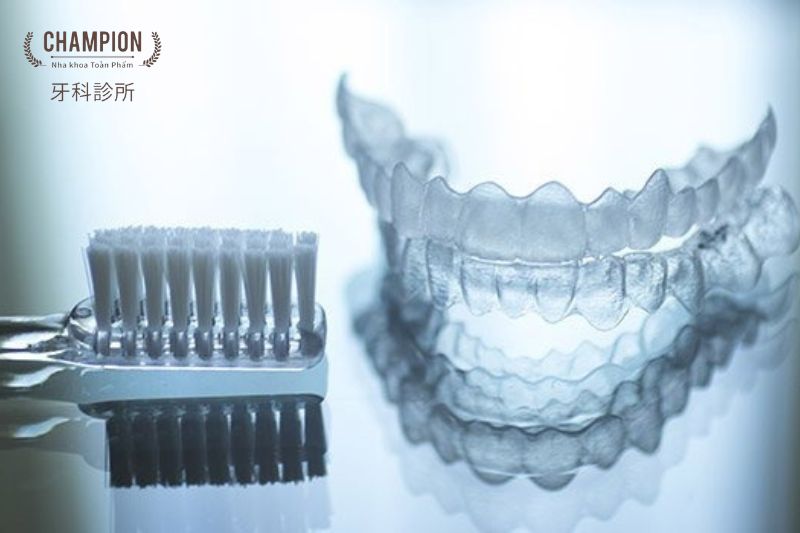 Khi nào cần phải vệ sinh khay niềng răng trong suốt Invisalign?